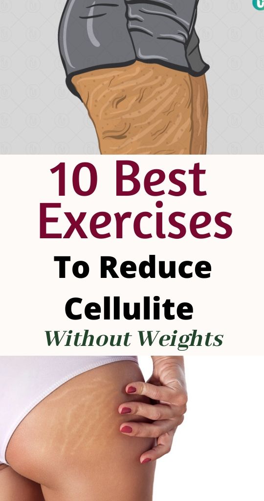 Read more about the article 10 Best Exercises to Reduce Cellulite Without Weights