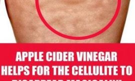 Apple Cider Vinegar Helps for the Cellulite to Disappear Magically!!